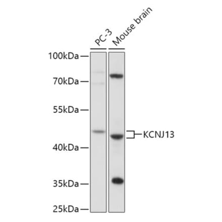 Western Blot - Anti-KCNJ13 Antibody (A306262) - Antibodies.com