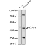 Western Blot - Anti-KCNJ13 Antibody (A306262) - Antibodies.com