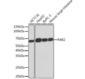 Western Blot - Anti-PAR2 Antibody [ARC1246] (A306265) - Antibodies.com