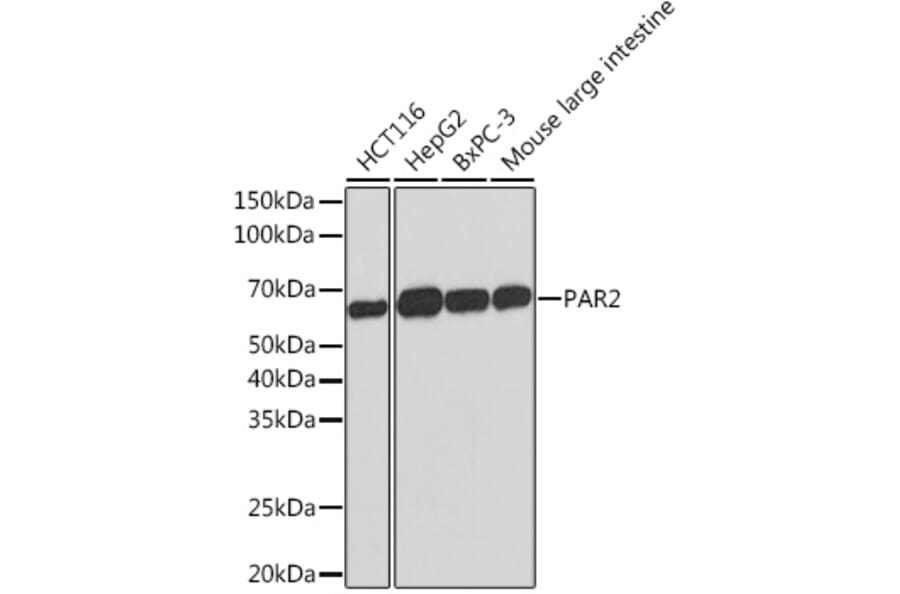 Western Blot - Anti-PAR2 Antibody [ARC1246] (A306265) - Antibodies.com