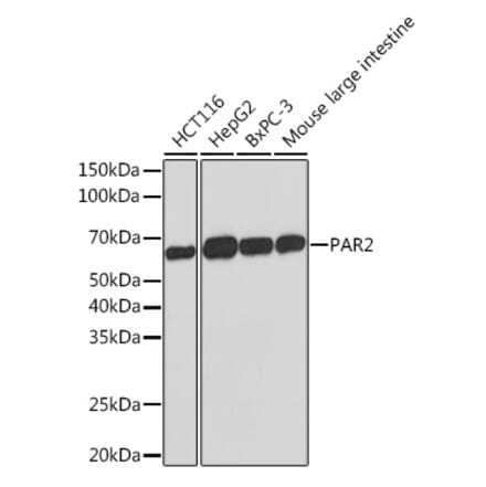 Western Blot - Anti-PAR2 Antibody [ARC1246] (A306265) - Antibodies.com