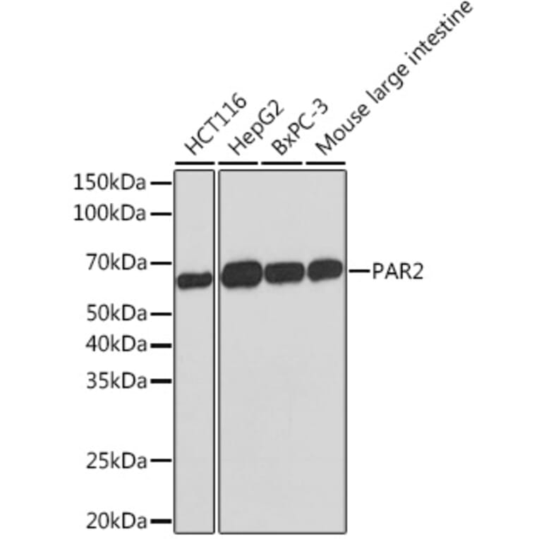 Western Blot - Anti-PAR2 Antibody [ARC1246] (A306265) - Antibodies.com