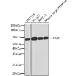 Western Blot - Anti-PAR2 Antibody [ARC1246] (A306265) - Antibodies.com
