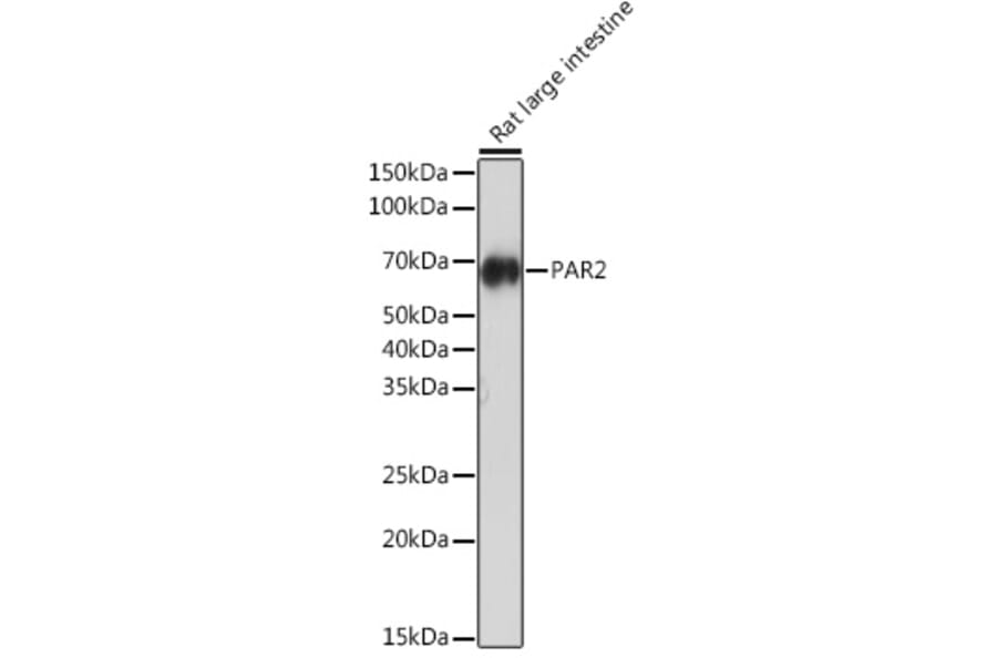 Western Blot - Anti-PAR2 Antibody [ARC1246] (A306265) - Antibodies.com