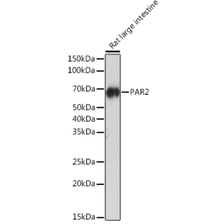 Western Blot - Anti-PAR2 Antibody [ARC1246] (A306265) - Antibodies.com