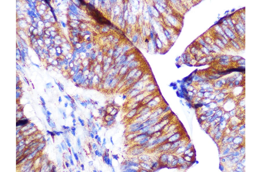 Immunohistochemistry - Anti-PAR2 Antibody [ARC1246] (A306265) - Antibodies.com