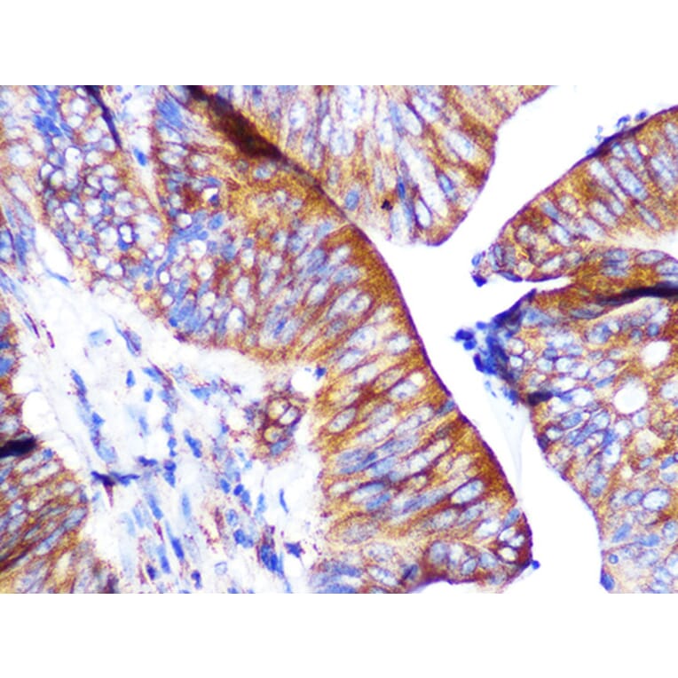 Immunohistochemistry - Anti-PAR2 Antibody [ARC1246] (A306265) - Antibodies.com