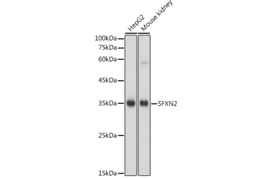 Western Blot - Anti-SFXN2 Antibody (A306267) - Antibodies.com