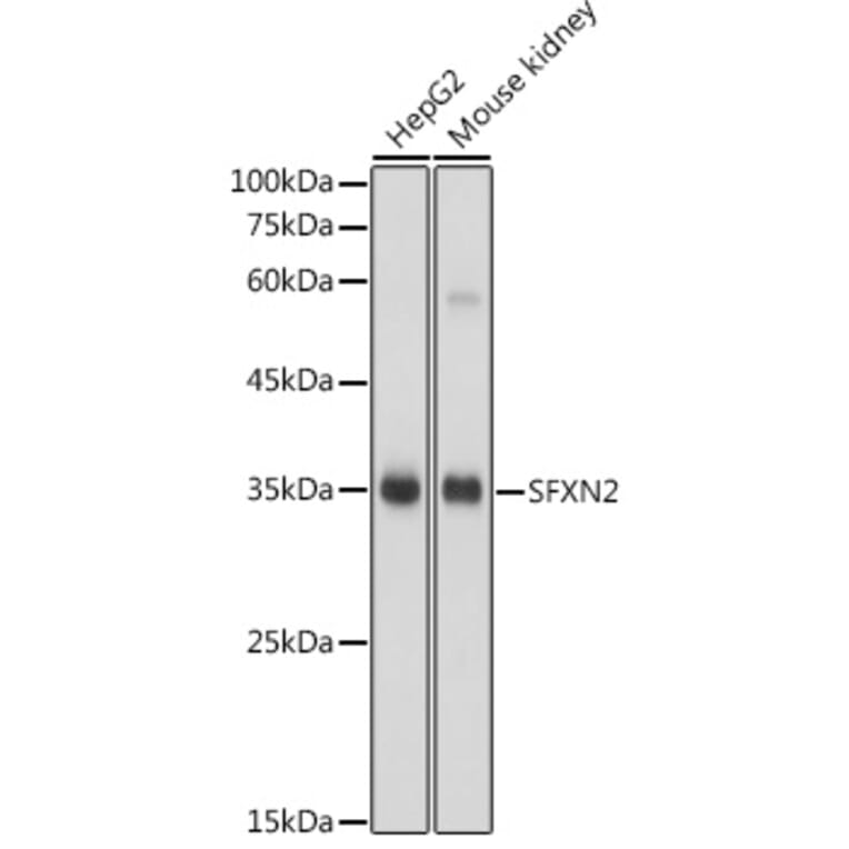 Western Blot - Anti-SFXN2 Antibody (A306267) - Antibodies.com