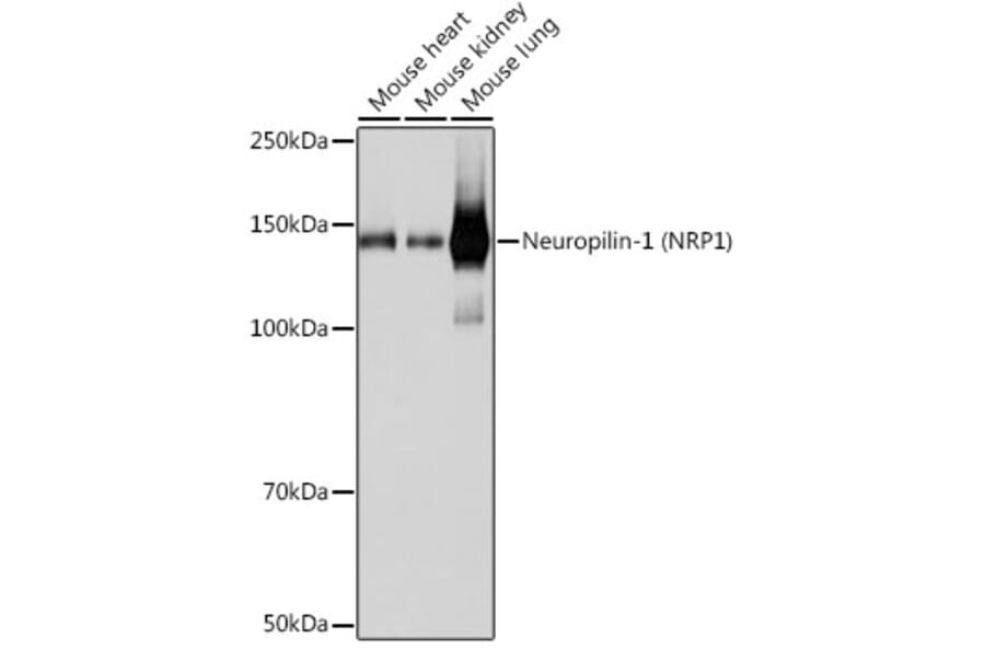 Western Blot - Anti-Neuropilin 1 Antibody [ARC0488] (A306268) - Antibodies.com