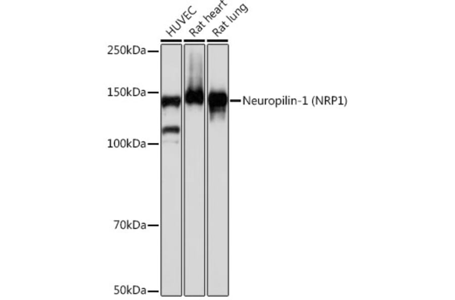 Western Blot - Anti-Neuropilin 1 Antibody [ARC0488] (A306268) - Antibodies.com