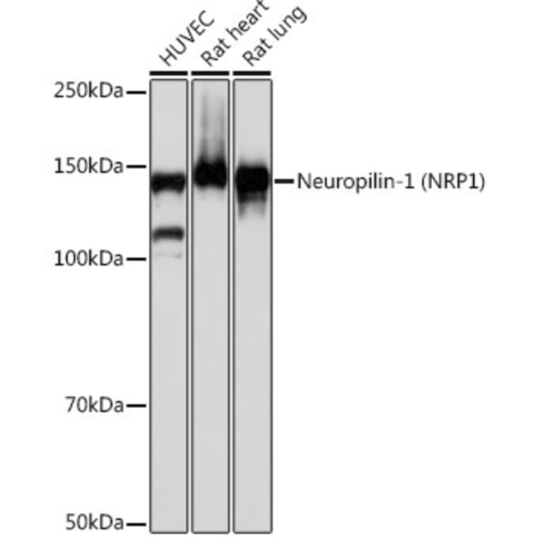 Western Blot - Anti-Neuropilin 1 Antibody [ARC0488] (A306268) - Antibodies.com