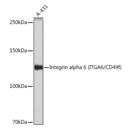Western Blot - Anti-Integrin alpha 6 Antibody [ARC51523] (A306270) - Antibodies.com