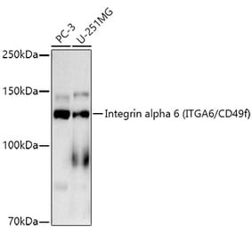 Western Blot - Anti-Integrin alpha 6 Antibody [ARC51524] (A306271) - Antibodies.com