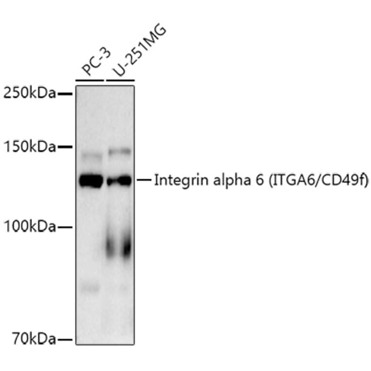 Western Blot - Anti-Integrin alpha 6 Antibody [ARC51524] (A306271) - Antibodies.com