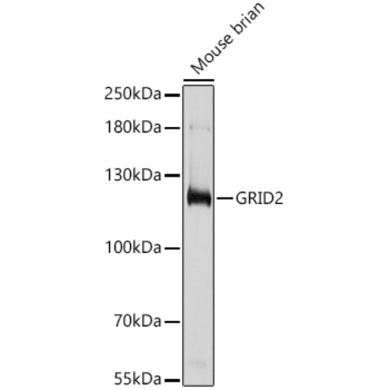 Western Blot - Anti-GRID2 Antibody (A306272) - Antibodies.com