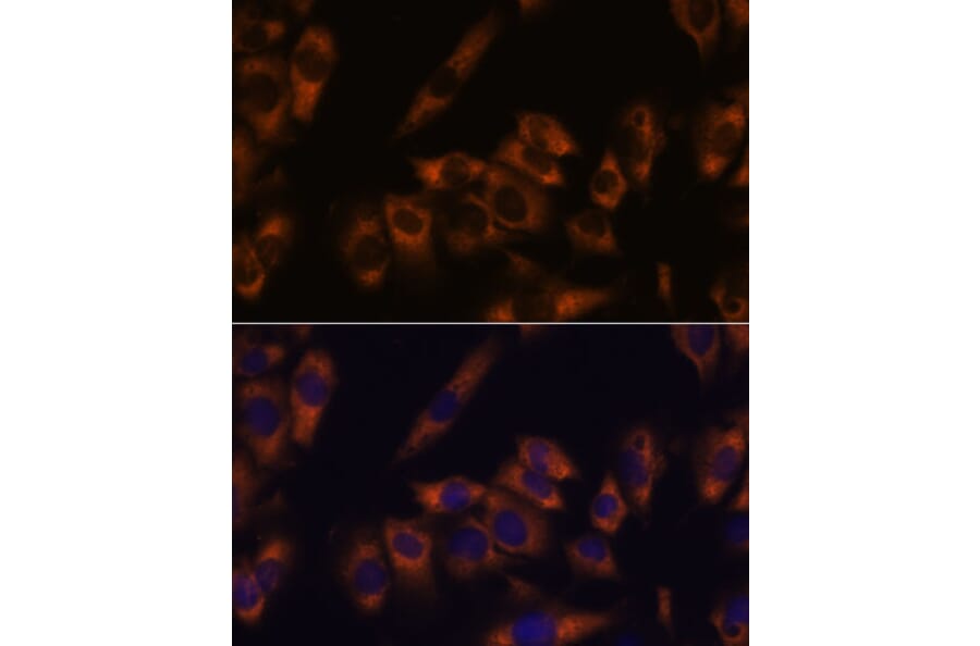 Immunofluorescence - Anti-GRID2 Antibody (A306272) - Antibodies.com