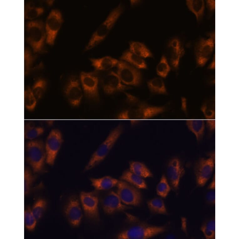 Immunofluorescence - Anti-GRID2 Antibody (A306272) - Antibodies.com