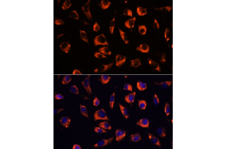 Immunofluorescence - Anti-GRID2 Antibody (A306272) - Antibodies.com