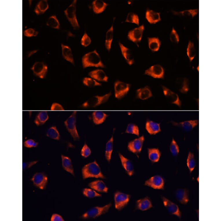 Immunofluorescence - Anti-GRID2 Antibody (A306272) - Antibodies.com