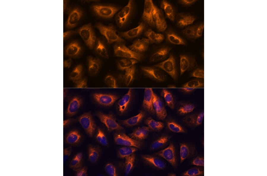 Immunofluorescence - Anti-GRID2 Antibody (A306272) - Antibodies.com