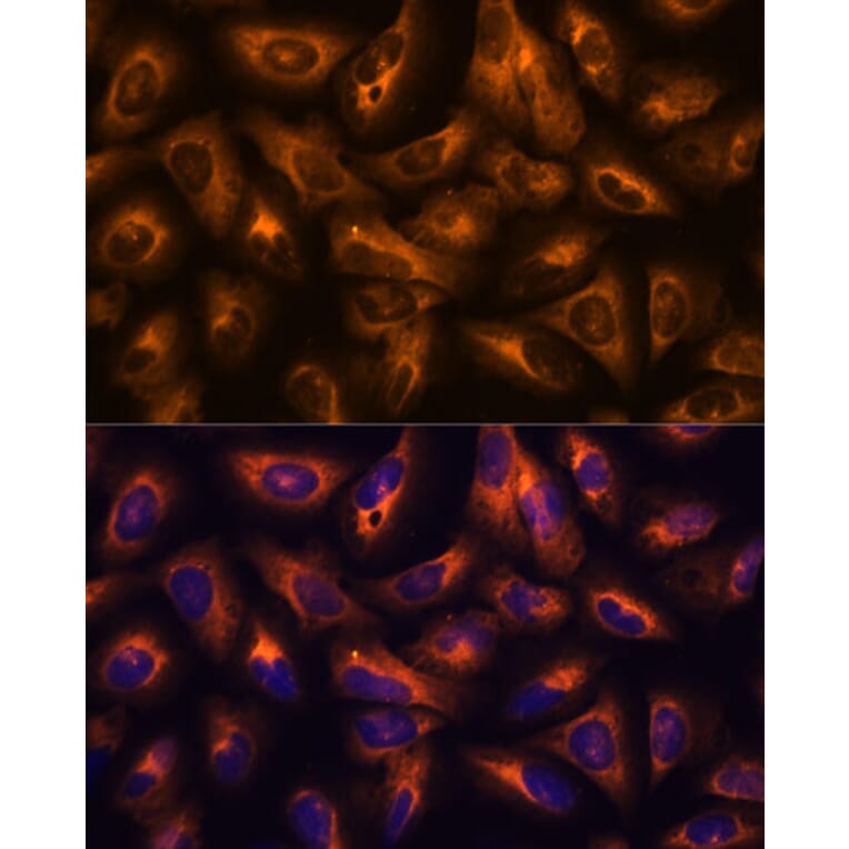Immunofluorescence - Anti-GRID2 Antibody (A306272) - Antibodies.com