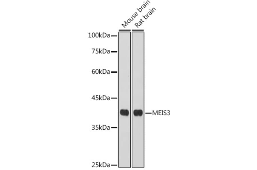 Western Blot - Anti-Meis homeobox 3/MEIS3 Antibody (A306273) - Antibodies.com