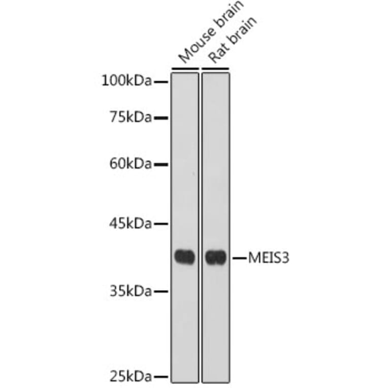 Western Blot - Anti-Meis homeobox 3/MEIS3 Antibody (A306273) - Antibodies.com
