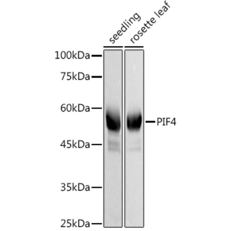 Western Blot - Anti-PIF4 Antibody (A306274) - Antibodies.com