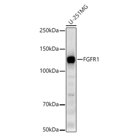 Western Blot - Anti-FGFR1 Antibody [ARC53424] (A306276) - Antibodies.com