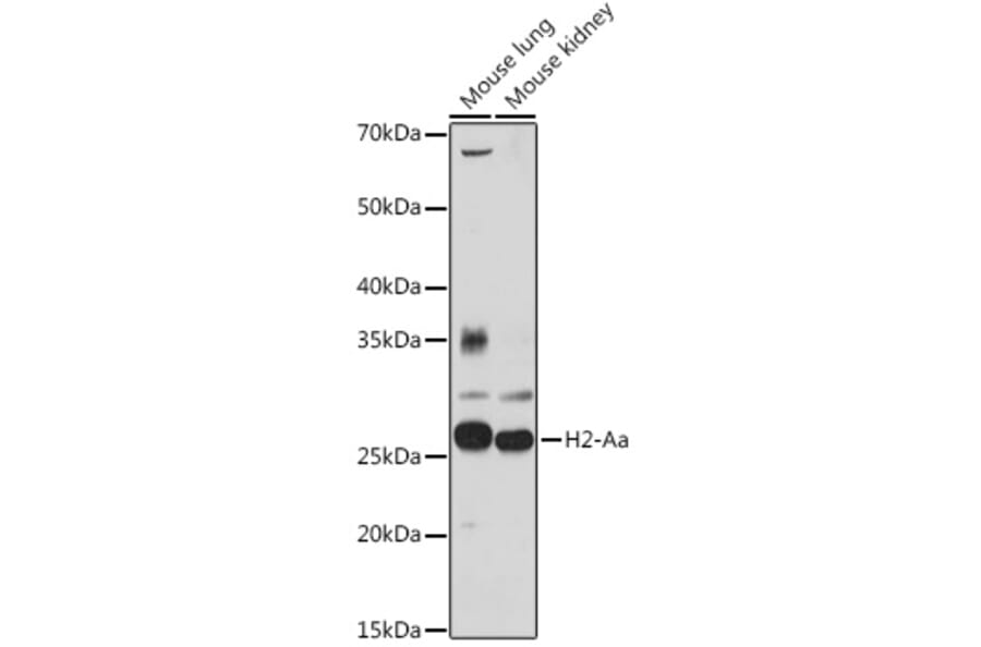 Western Blot - Anti-H2-Aa Antibody (A306277) - Antibodies.com