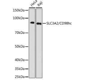 Western Blot - Anti-CD98 Antibody [ARC0816] (A306279) - Antibodies.com