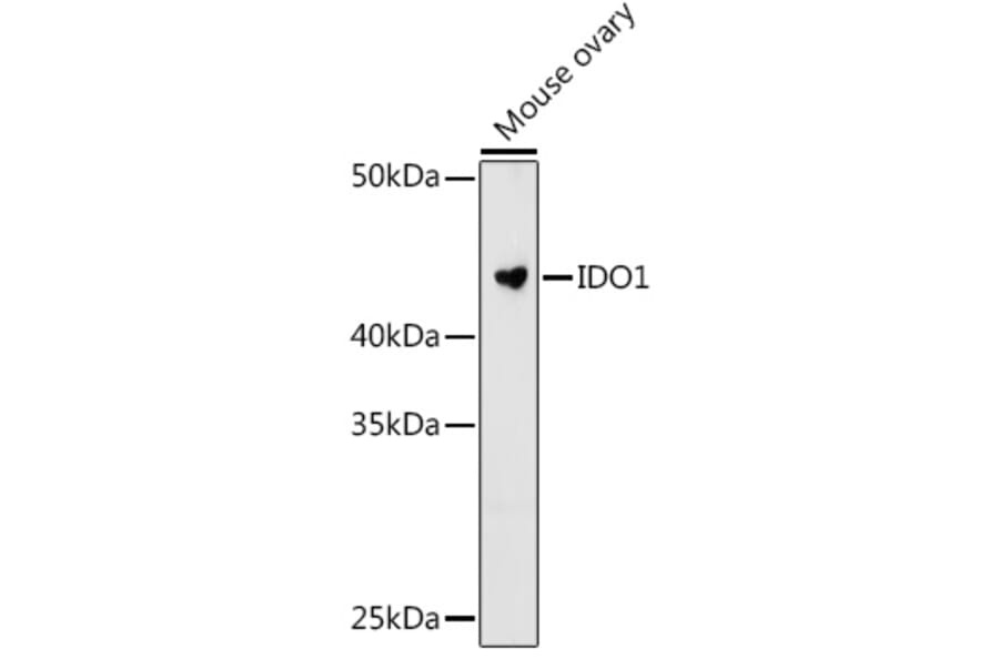 Western Blot - Anti-Indoleamine 2, 3-dioxygenase Antibody [ARC0560] (A306280) - Antibodies.com