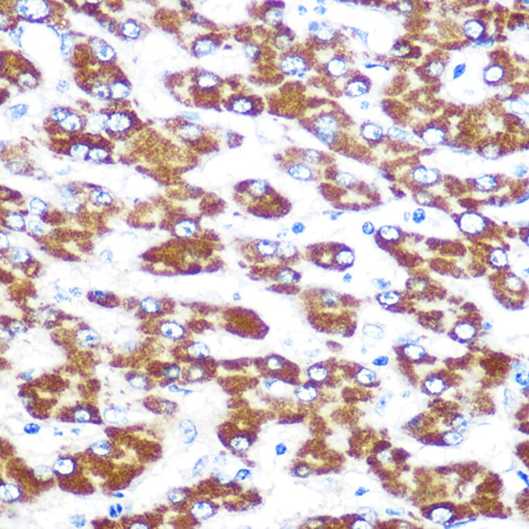 Immunohistochemistry - Anti-Indoleamine 2, 3-dioxygenase Antibody [ARC0560] (A306280) - Antibodies.com