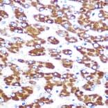 Immunohistochemistry - Anti-Indoleamine 2, 3-dioxygenase Antibody [ARC0560] (A306280) - Antibodies.com