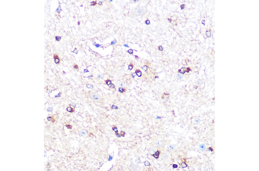 Immunohistochemistry - Anti-Indoleamine 2, 3-dioxygenase Antibody [ARC0560] (A306280) - Antibodies.com