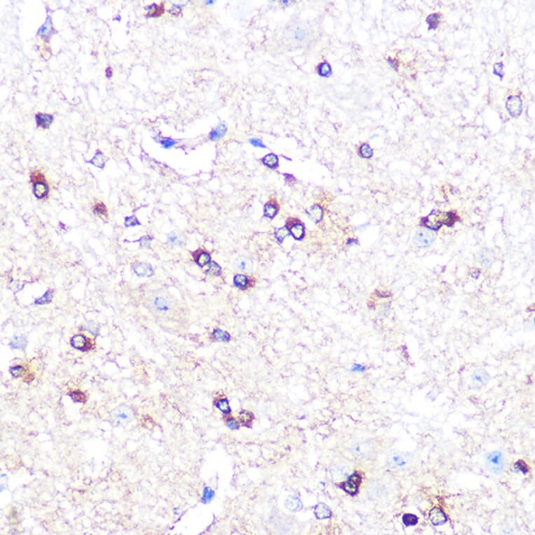 Immunohistochemistry - Anti-Indoleamine 2, 3-dioxygenase Antibody [ARC0560] (A306280) - Antibodies.com