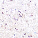 Immunohistochemistry - Anti-Indoleamine 2, 3-dioxygenase Antibody [ARC0560] (A306280) - Antibodies.com