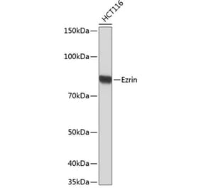 Western Blot - Anti-Ezrin Antibody [ARC0392] (A306281) - Antibodies.com