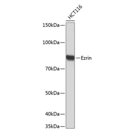 Western Blot - Anti-Ezrin Antibody [ARC0392] (A306281) - Antibodies.com