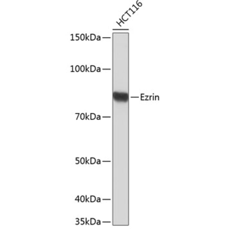 Western Blot - Anti-Ezrin Antibody [ARC0392] (A306281) - Antibodies.com