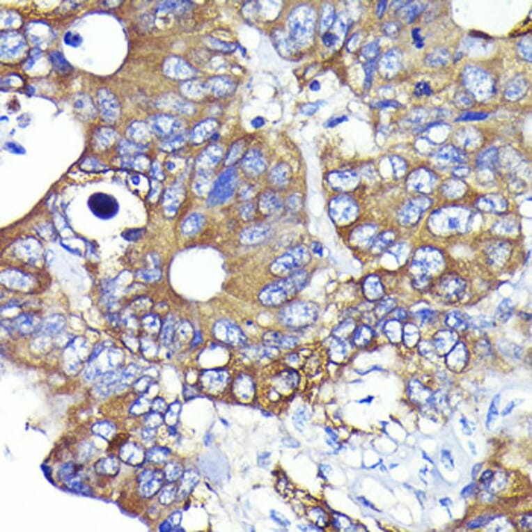 Immunohistochemistry - Anti-Ezrin Antibody [ARC0392] (A306281) - Antibodies.com