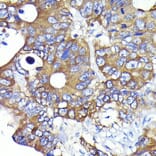 Immunohistochemistry - Anti-Ezrin Antibody [ARC0392] (A306281) - Antibodies.com