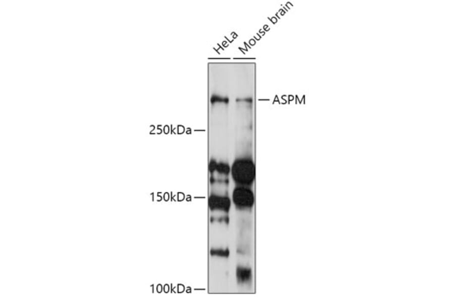 Western Blot - Anti-ASPM Antibody (A306282) - Antibodies.com