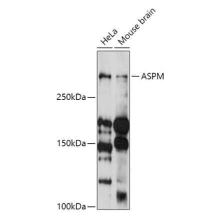Western Blot - Anti-ASPM Antibody (A306282) - Antibodies.com