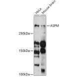 Western Blot - Anti-ASPM Antibody (A306282) - Antibodies.com
