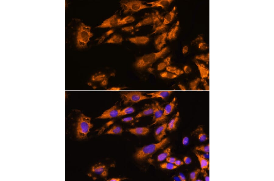 Immunofluorescence - Anti-ASPM Antibody (A306282) - Antibodies.com