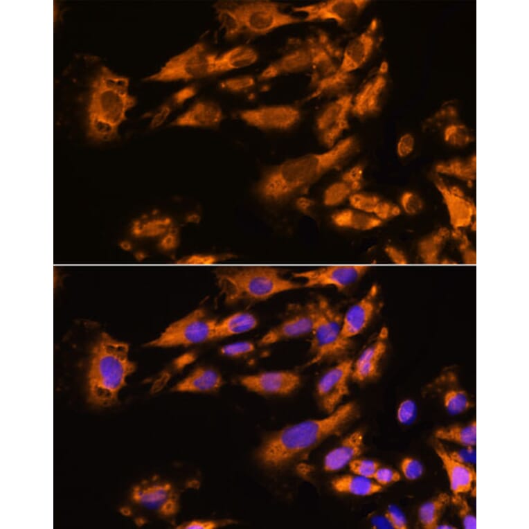 Immunofluorescence - Anti-ASPM Antibody (A306282) - Antibodies.com