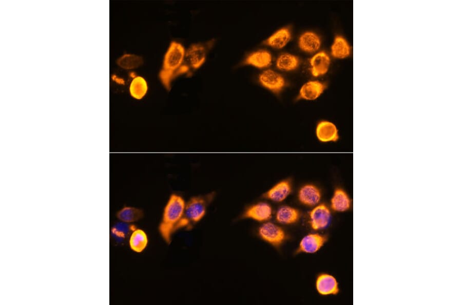 Immunofluorescence - Anti-ASPM Antibody (A306282) - Antibodies.com