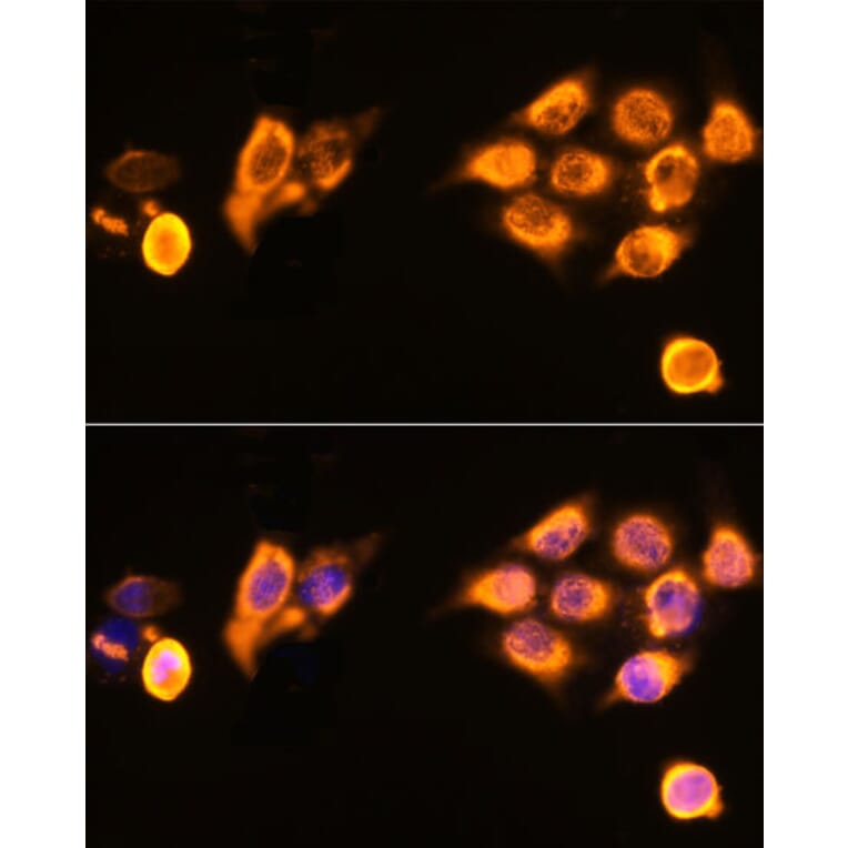 Immunofluorescence - Anti-ASPM Antibody (A306282) - Antibodies.com